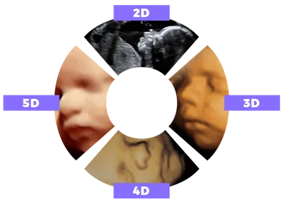 4D ultrasound 5D ultrasound Book Now! - 3D ultrasound