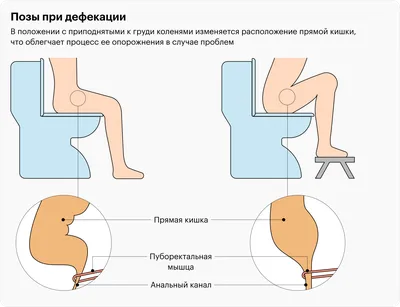 Почему нельзя долго сидеть в туалете: ответ проктолога