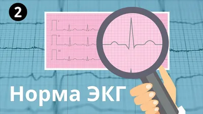 Расшифровка ЭКГ - купить спорта, красоты и здоровья в интернет-магазинах,  цены на Мегамаркет | 219275