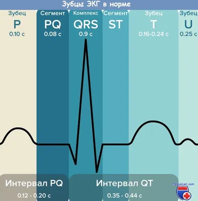 Суточное мониторирование ЭКГ по Холтеру в СПБ - цена, запись