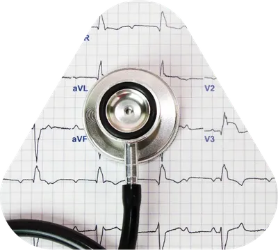 Комплексный подход в кардиологии – ЭКГ с расшифровкой бесплатно | Акции  клиник Столица