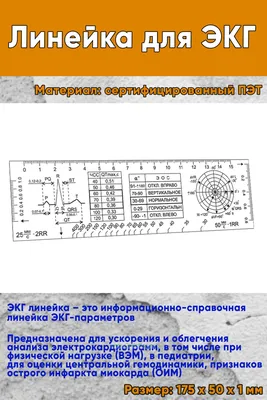 Иллюстрация 32 из 34 для Полный курс по расшифровке ЭКГ - Сергей Миронов |  Лабиринт - книги. Источник: