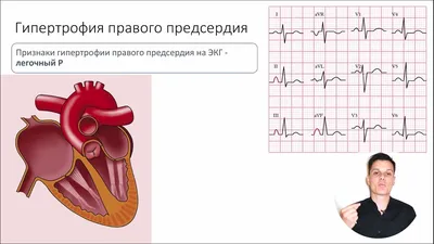 ЭКГ Фрязино Щелково платно - медицинский центр О3