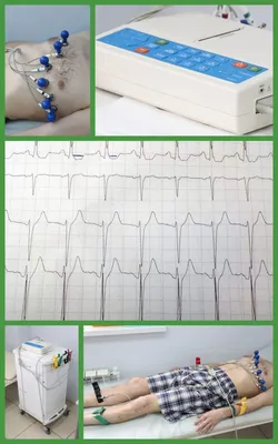 Сделать электрокардиографию платно - цена ЭКГ сердца взрослому в Москве
