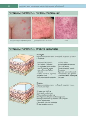 Иллюстрация 1 из 33 для Кожные и венерические болезни - Адаскевич, Козин |  Лабиринт - книги. Источник: Лабиринт