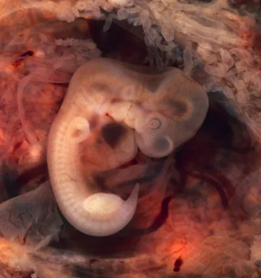 Эмбрион, 18 недель»: возможно, величайшая фотография 20-го века