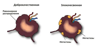 Почему воспаляются лимфоузлы на шее и что с этим делать - Лайфхакер