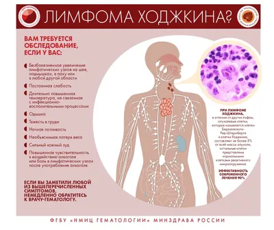 Уплотнения в области паха у детей | Клиника Фэнтези