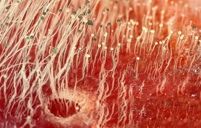 Лечение грибковых инфекций кожи и ногтей: противогрибковые препараты  широкого спектра действия