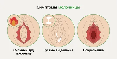 Причины, симптомы и лечение грибковой инфекции: чем лечить микоз ногтей и  кожи