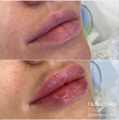 Очень красивые губы: lena-miro.ru — LiveJournal