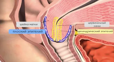 эрозии и микротрещины аноректальной зоны