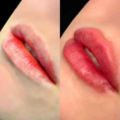 Почему губы трескаются и шелушатся, и что с этим делать? Советы экспертов |  Beauty Insider