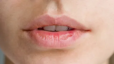 Губы💋💋 | Губы, Мягкие губы, Матовые губы