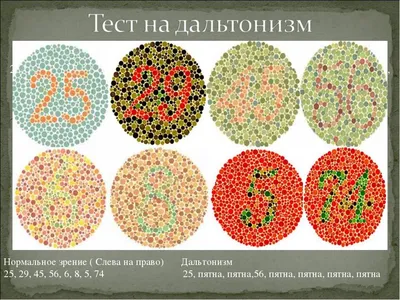 Тест на цветовосприятие (дальтонизм) в Выксе | Клиника «Ника Спринг»