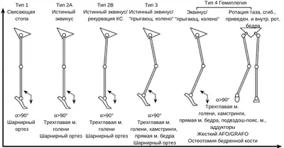 Церебральный паралич - причины появления, симптомы заболевания, диагностика  и способы лечения