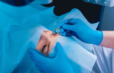 Заживает ли лоскут после ЛАСИК: статья офтальмологического центра Санта