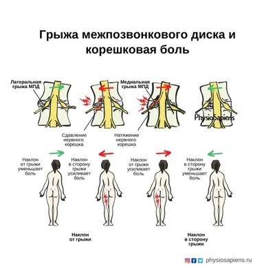 Настоящая причина болей в пояснице, и почему она возникает. | Мамкин  инвестор-любитель | Дзен