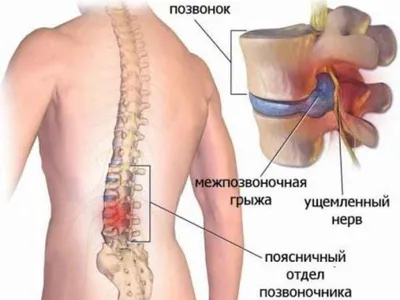 20 упражнений Бубновского для дома, видео | ТОП упражнения Бубновского