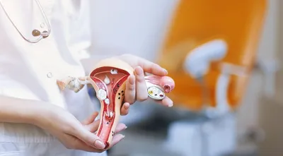 Молочница: симптомы, причины, лечение вагинального кандидоза у женщин в  клинике АльтраВита