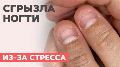 ОБГРЫЗЕННЫЕ ногти/наращивание обкусаных ногтей/преображение/новогодний  дизайн - YouTube