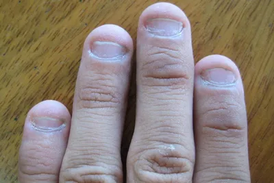 Много лет грызли ногти: как восстановить их у мастера маникюра | Лизи Визи  | Дзен