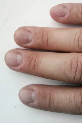 Обгрызенные ногти к девятисотому (60 фото)