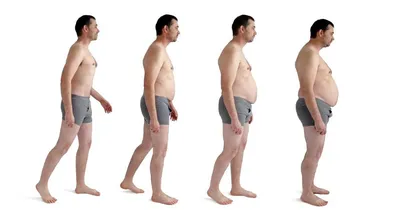 Почему люди страдают ожирением, причины и лечение - Лицам страдающим  ожирением противопоказаны