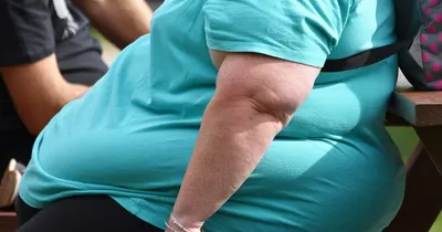 Ожирение у детей. Причины и последствия