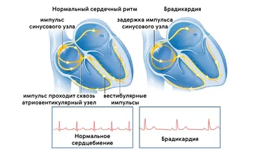 Как снизить пульс в домашних условиях: эффективные методы и советы |  Женский журнал Клео | Дзен