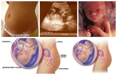 Беременность в картинках - развитие плода по неделям с подробным описанием