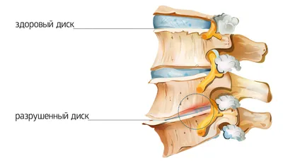 Гормональный фон, работа щитовидной железы и при чем тут шейный остеохондроз?  | Блог Доктора Шишонина | Дзен
