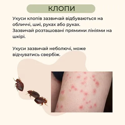 Опасные насекомые и их укусы — блог медицинского центра ОН Клиник