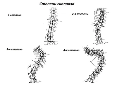 ЛФК при нарушении обмена веществ | Физкультура, Медицина, Упражнения