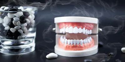 Протезирование на имплантах при полном отсутствии зубов — ROOTT