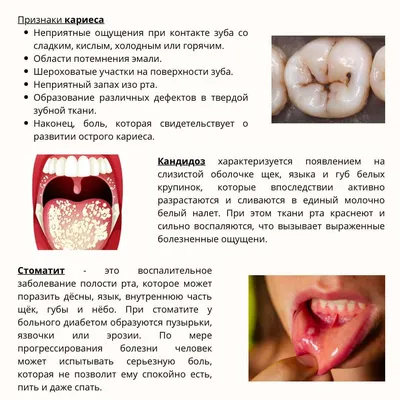 Белые язвочки во рту - причины и лечение