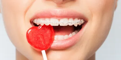 Основные заболевания слизистой оболочки полости рта | Galsi-Dental