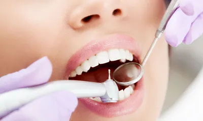 Как здоровье зубов влияет на сердечно-сосудистую систему